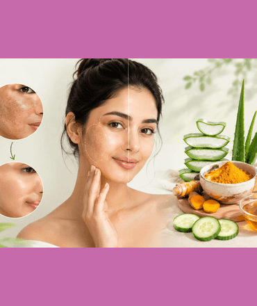 How to Remove Dark Spots Naturally at Home